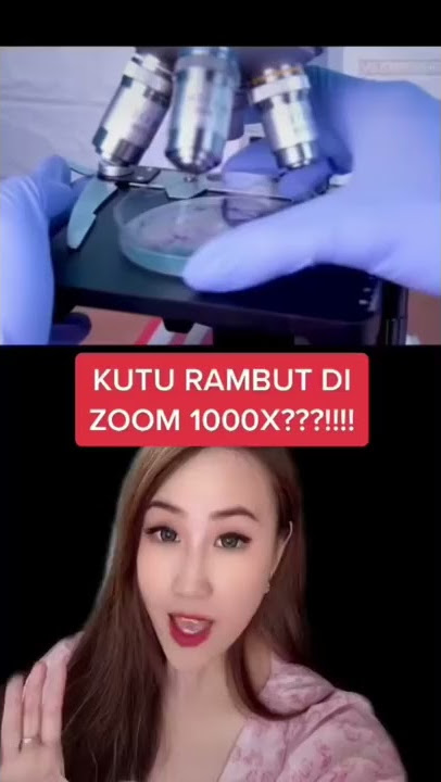 KUTU RAMBUT DI ZOOM 1000X?!! JIJIK!!! #Shorts