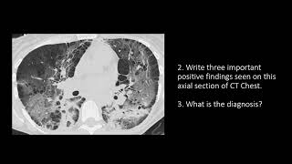 DRREAMS OSCE Series: OSCE 9