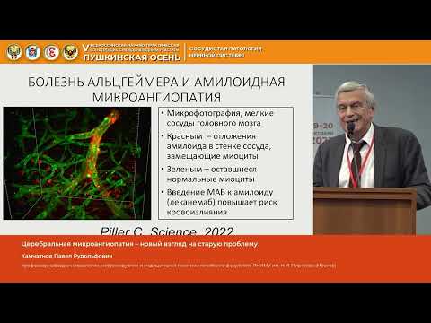 Камчатнов Павел Рудольфович Церебральная микроангиопатия – новый взгляд на старую проблему