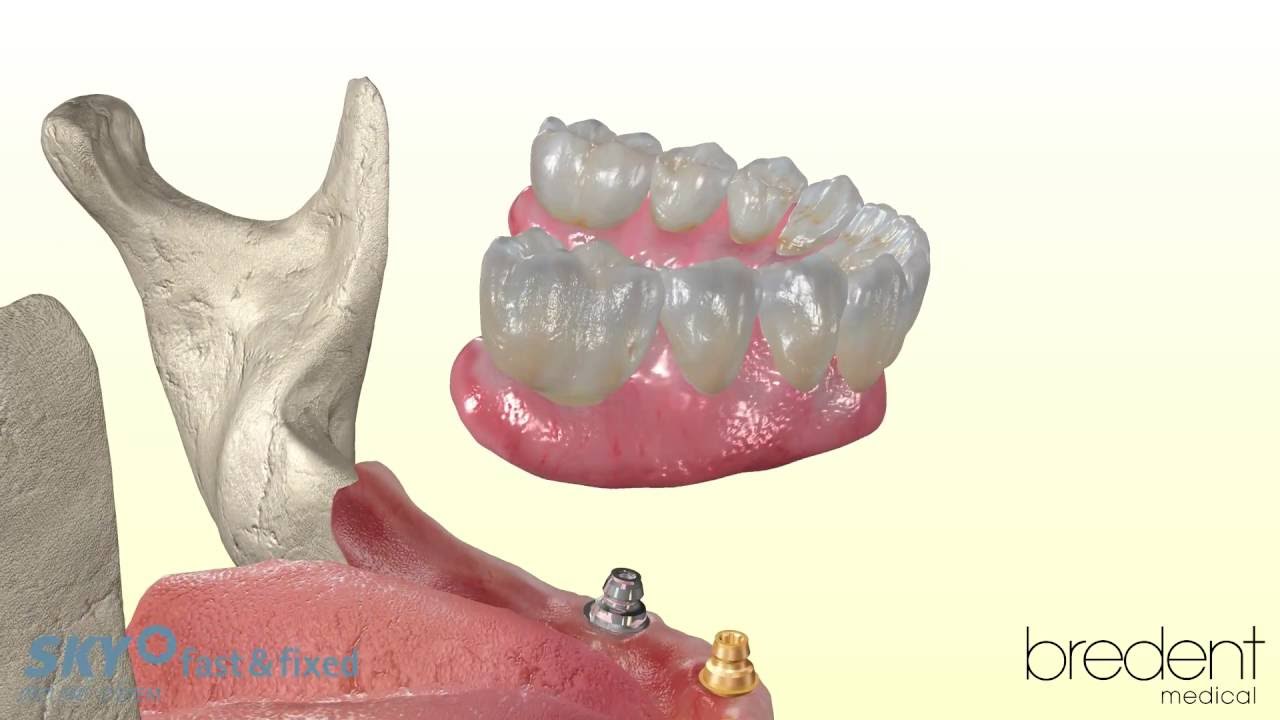 SKY fast & fixed   3D Animation