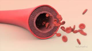 Vasodilation