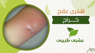 ☘ ماهو الخشخاش وما هى استخداماته المتنوعه ؟ | دواء علاج خراج