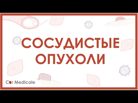 Сосудистые новообразования: саркома Капоши, гемангиома, ангиосаркома - кратко