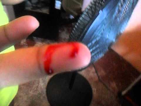What Happens If You Get Bit By A Dog What Happens If You Get Bit By A Dog
