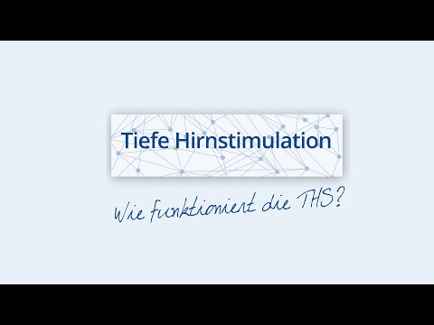 Tiefen Hirnstimulation an der Klinik für Neurologie