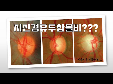 녹내장검진에서 &rsquo;시신경유두함몰비&rsquo; 라는 말이 도대체 무슨 뜻일까?