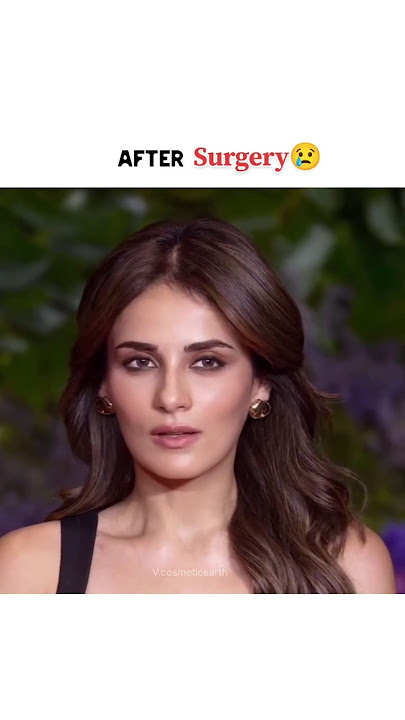 Radhika madan after surgery😢💔#shorts #radhikamadan #bollywood #transformation #plasticsurgery