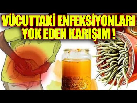 Vücuttaki enfeksiyonları tedavi eden ve parazitleri öldüren en güçlü doğal antibiyotik