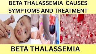 Beta Thalassemia Gejala Penyebab U0026 Pengobatan