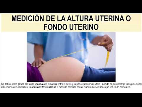 Medición de la altura uterina o fondo uterino - YouTube