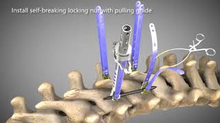 Waston Medical Master7 MIS system