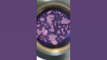 Platelet count in micro scop #pathologylaboratory #machine #biochemistry #hematology #microscope