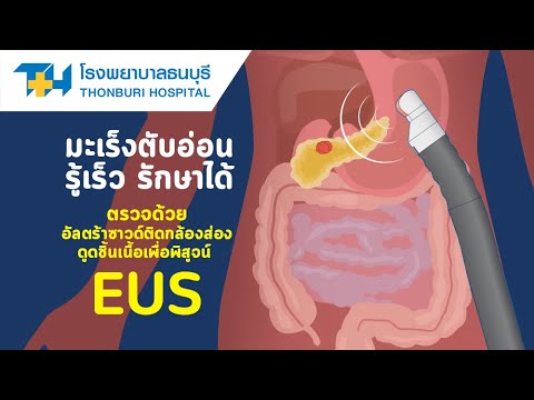 โรงพยาบาลธนบุรี : "มะเร็งตับอ่อน" รู้เร็ว รักษาได้
