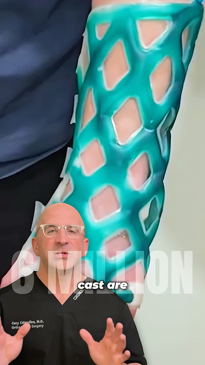 New Waterproof Cast Option For Broken Bones 🌊