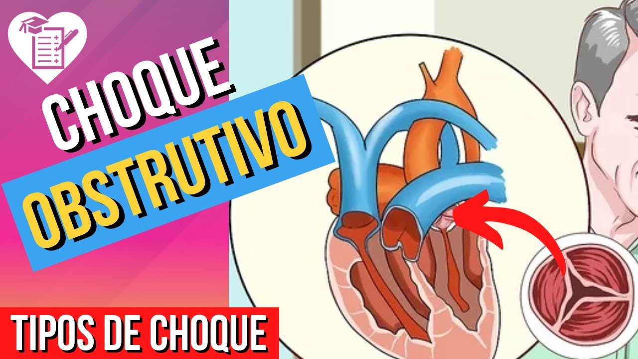 CHOQUE OBSTRUTIVO Causas, Sintomas e Tratamento YouTube