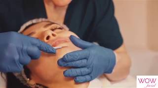 Corporate Promo Video :: WOW facial demonstration :: Mesotherapy Microneedling