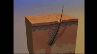 UNABELLE ESTÉTICA AVANÇADA CRICIÚMA - MÉTODO DE DEPILAÇÃO A LASER DE DIODO LIGTH SHEER