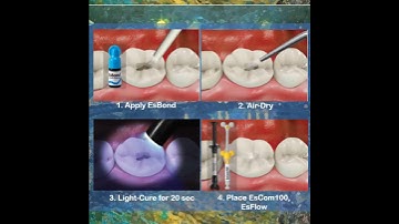 [SPIDENT] EsBond - Product introduction