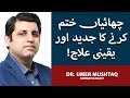 Chaiyan Khatam Karne Ka Tarika | How To Treat Pigmentation Permanently | Dr. Umer Mushtaq