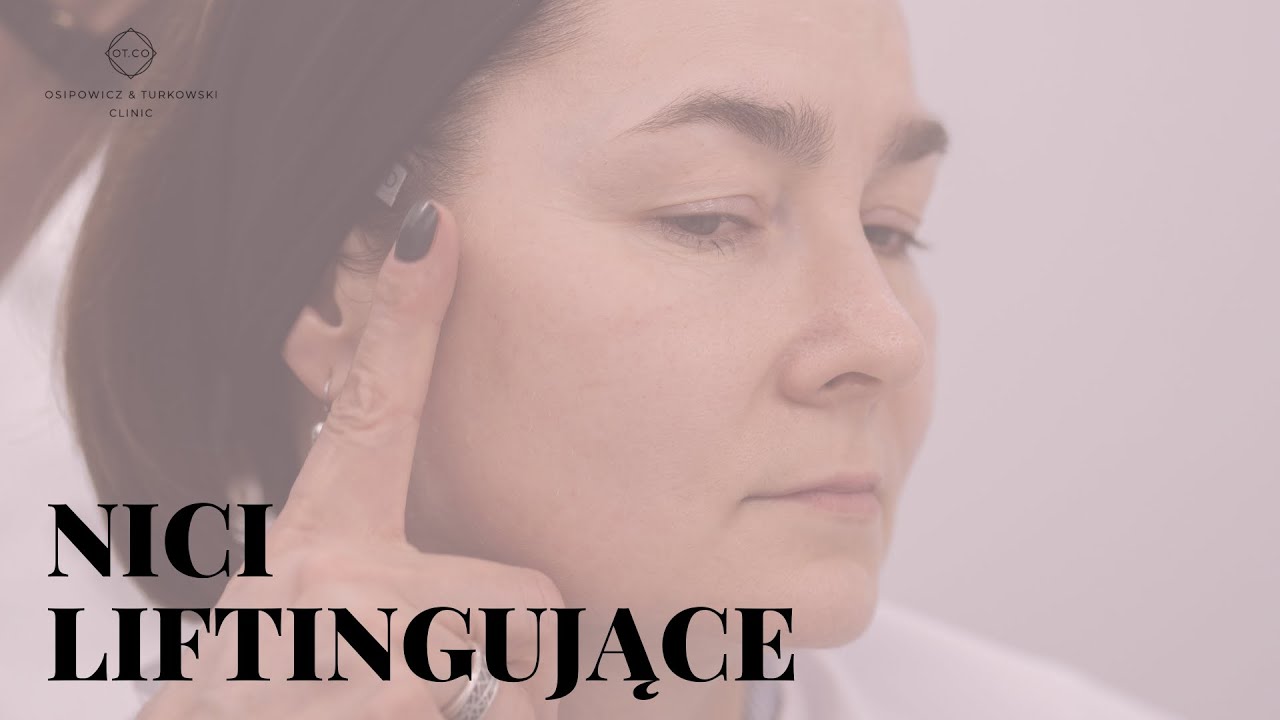 Nici liftingujące - przebieg zabiegu i wskazania