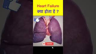 What is Heart Failure | Heart failure  में Pulmonary Edema और Peripheral edema क्यों होता  shorts