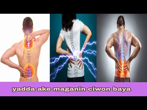 Abubuwan da ke kawo ciwon baya da maganin sa