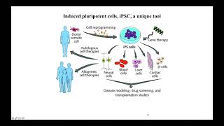 iPSpine IPSC webinar part 1