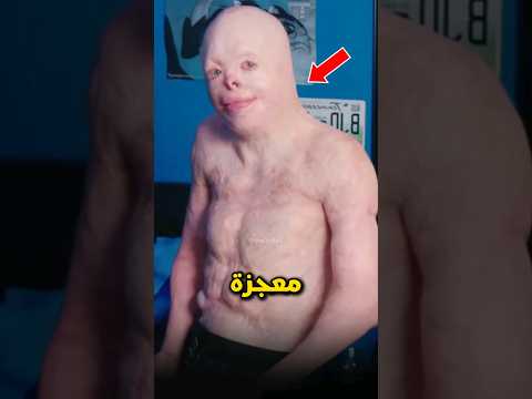 هذا الشاب معجزة بالفعل هذا الشاب معجزة بالفعل
