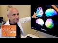Meet the Psychiatrist Who Cures the Brain | California Live | NBCLA Mp3 Song