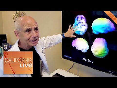 Meet the Psychiatrist Who Cures the Brain | California Live | NBCLA