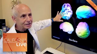 Meet the Psychiatrist Who Cures the Brain | California Live | NBCLA