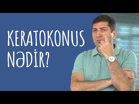 Video: Keratokonus Necə İdarə Edilir: Təbii və Tibbi Metodlar