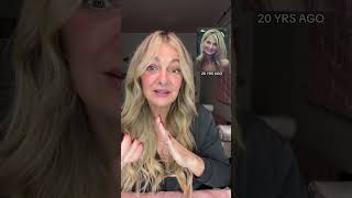 Post facelift comparison at 9 weeks vs 20 years ago
