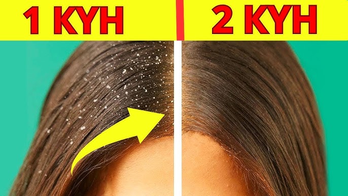 Интернеттегі порнографиялық қоқыс