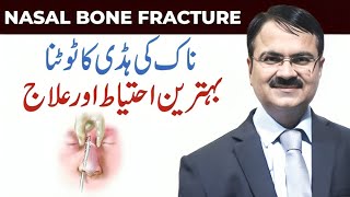 Nasal Bone Fracture | Broken Nose Causes, Symptoms & Treatment | Best Care After Nose Injury