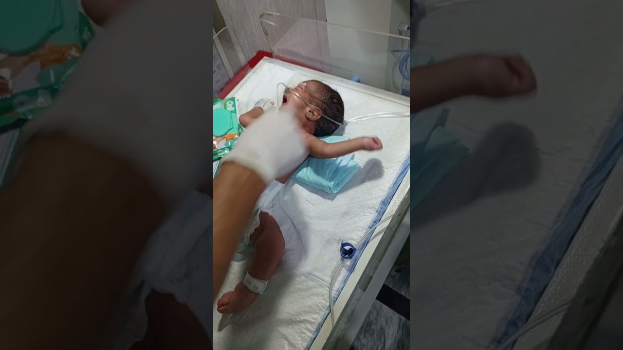 23-Day-Old Baby in NICU | CHD, Sepsis & Genetic Syndrome Care | NG Tube Feeding by Male Nurse