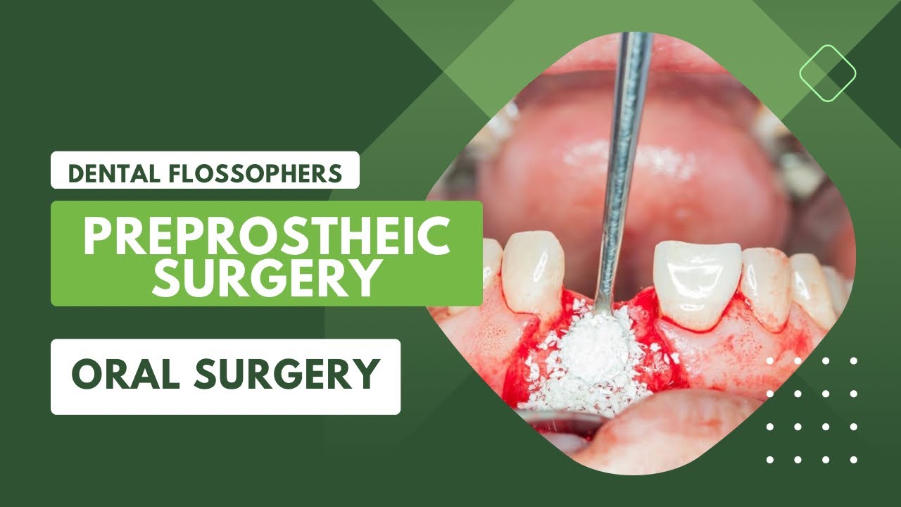 PREPROSTHETIC SURGERY ORAL SURGERY BDS ALVEOLOPLASTY