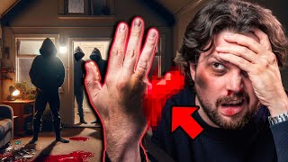Why my finger will never be the same... (insane story)