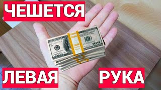 Чешется левая рука зудит и горит ладонь это к деньгам ?