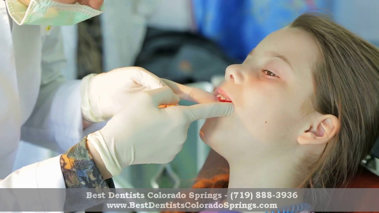 Kids Dentist Colorado Springs Colorado Springs Pediatric Dentistry YouTube