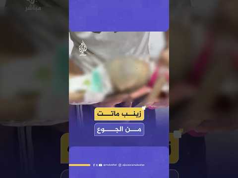 استش هاد الرضيعة زينب أبو حليب 6 أشهر في مستشفى ناصر الطبي جراء سوء التغذية