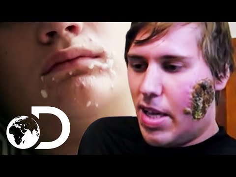 The Most Disturbing Parasites Found Inside Humans! | Monsters Inside Me
