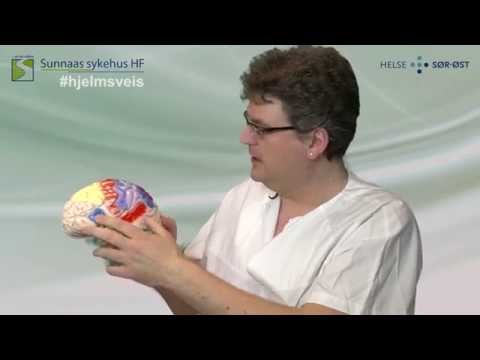 Video: C3aR Signalering Og Gliose Som Respons På Nevroutviklingsskader I Lillehjernen