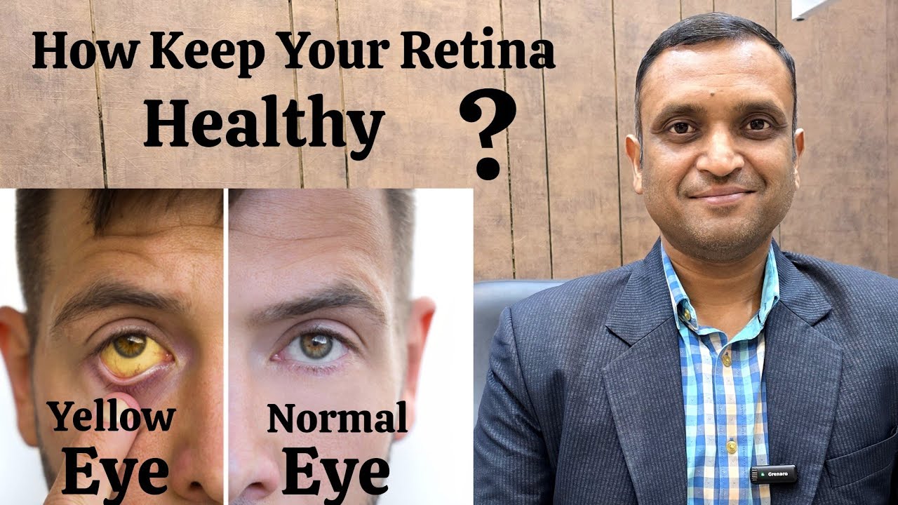 How to keep Retina healthy ? Retina Problems in eyes ?