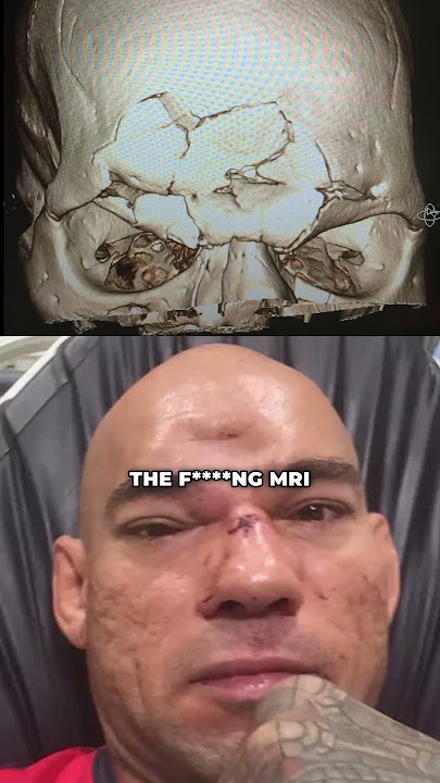 MVP vs Cyborg Santos - Career-Changing Moment #cyborg #mma #michaelvenompage