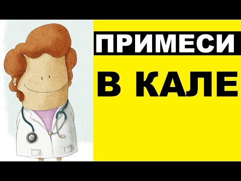 Примеси в кале: 5 признаков, которые должны вас насторожить