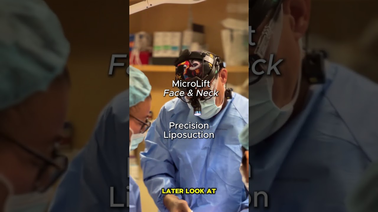 “55-Year-Old Zoe’s 1-Month MicroLift Transformation | Snatched Jawline & Smooth Neck Reveal”