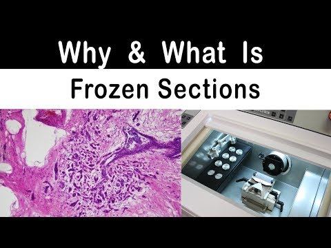 Why and what is Frozen Sections ?
