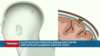 Elon Muskın Firmasına Insanlarda Beyin Implantları Çalışması Için Fda Onayı Voa Türkçe