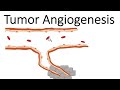 Understanding Tumor Angiogenesis